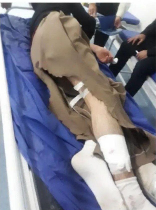 زخمی شدن چهار کولبر در مناطق مرزی پاوه، شوشمی و نوسود