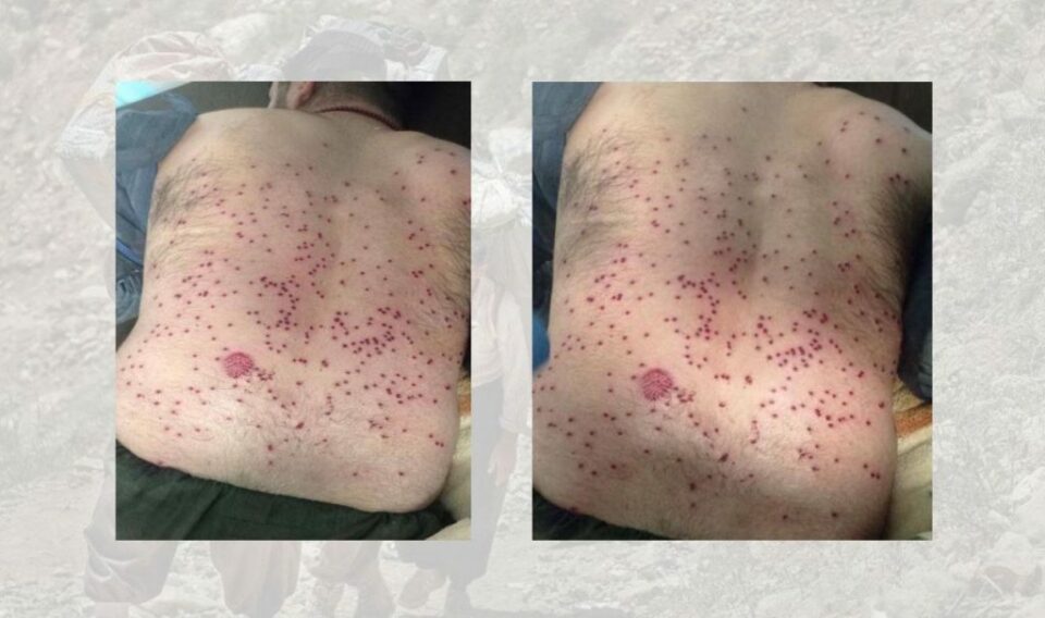 زخمی شدن یک کولبر در نوار مرزی بانه1