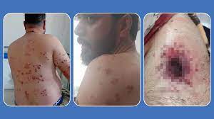 زخمی شدن دست‌کم ۲۱ نفر در تیراندازی نظامیان حکومتی به کاروان کولبران