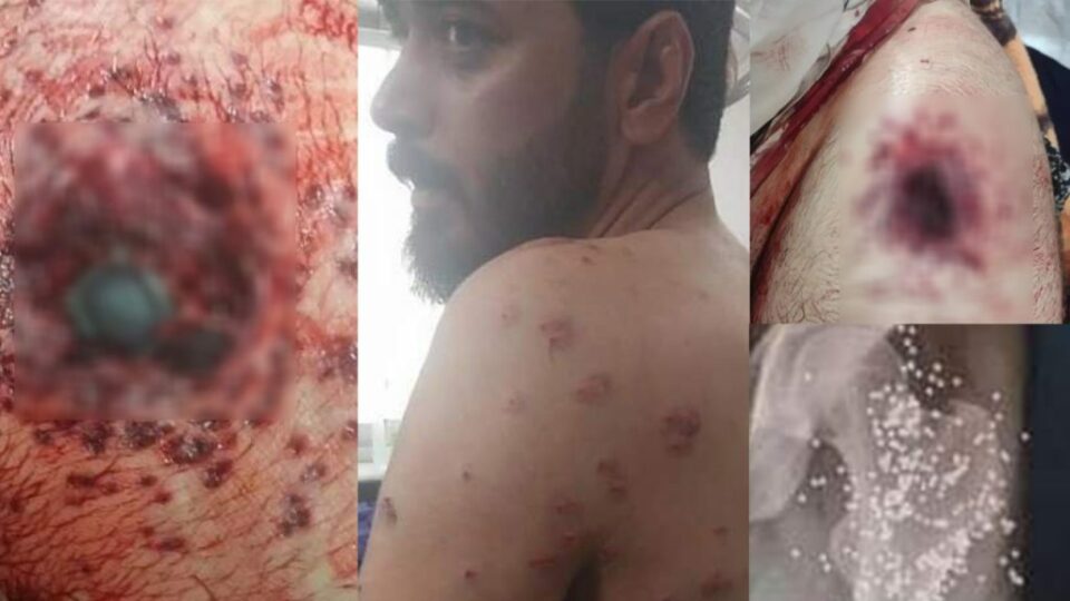 مجروح شدن ١٨ کولبر توسط هنگ‌مرزی