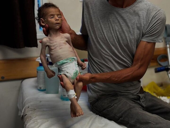 مرگ ۸۰ کودک فلسطینی در غزه بر اثر گرسنگی در یک روز