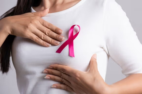 افزایش شمار ابتلای زنان به  سرطان پستان  در ایران