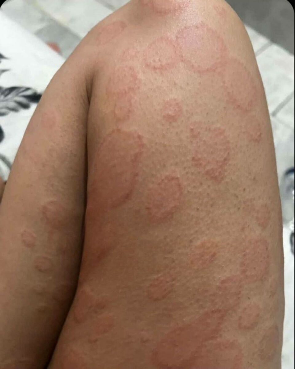 استفاده از گازهای سمی ناشناخته علیه معترضان در ایران