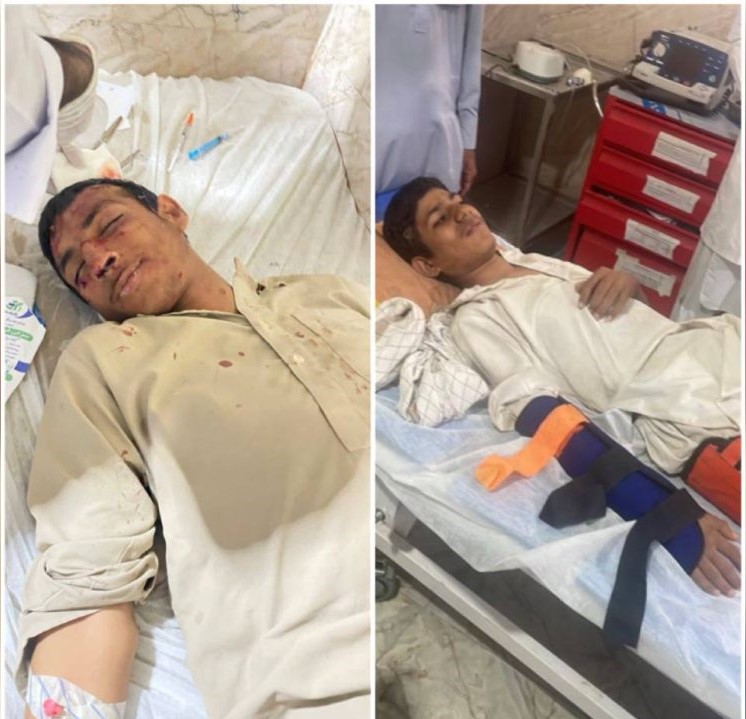 زخمی شدن پنج دانش آموز بلوچ بدنبال نبود سرویس مدرسه در سرباز4