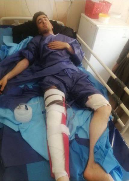 زخمی شدن یک کولبر دیگر با تیراندازی نظامیان حکومتی در نوسود کرمانشاه