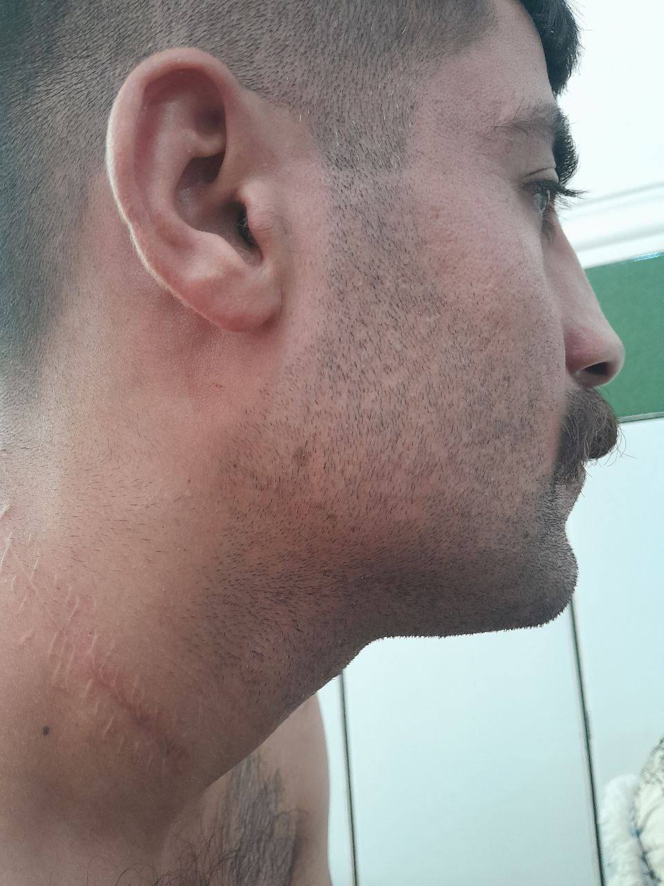 ابتلای صمد پورشه به دیسک گردن بر اثر شکنجه‌های اطلاعات سپاه