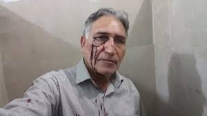 خطر نابینایی محمد نوری زاد زندانی سیاسی به دلیل ممانعت از درمان